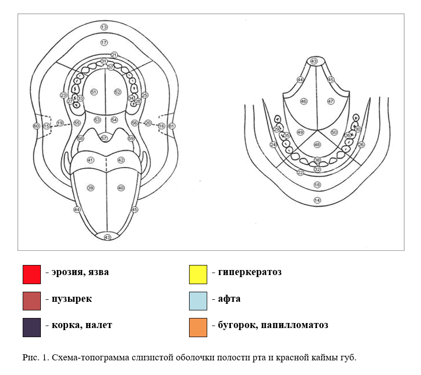 Схема-топограмма