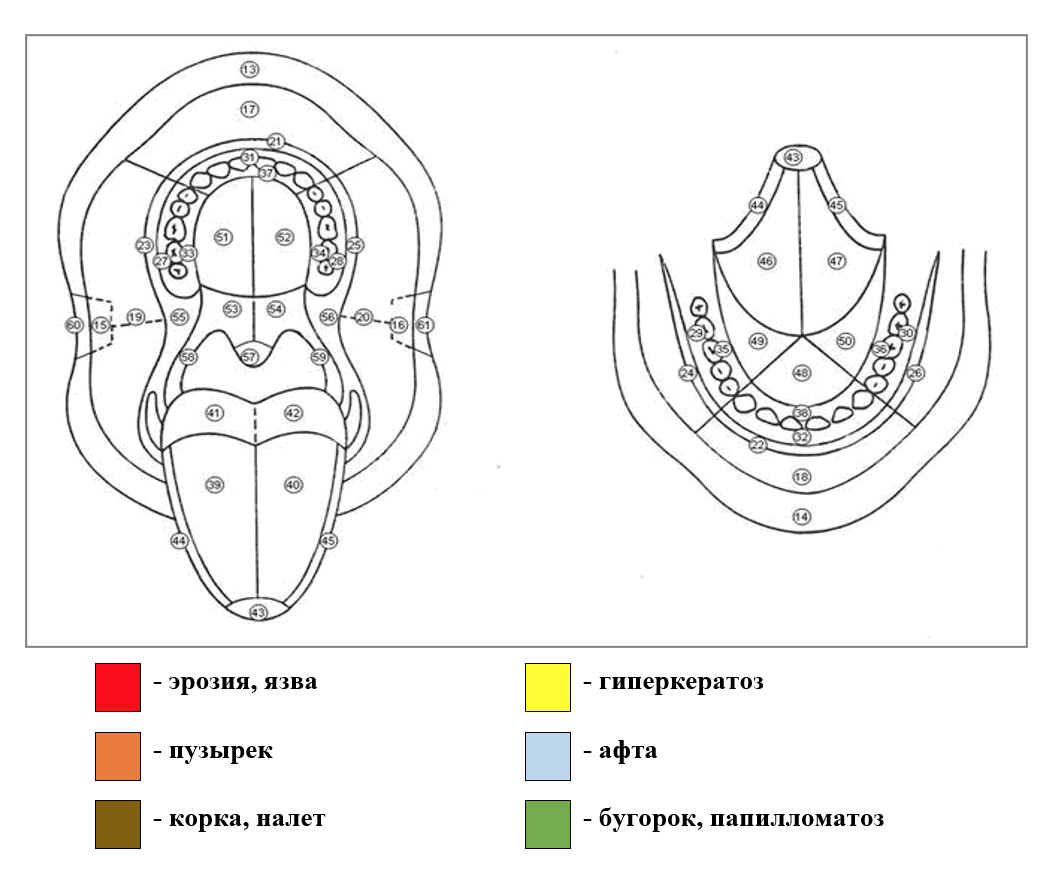 Топограмма СОПР
